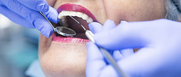 Best Emergency Dental Care for Broken or Chipped Teeth in Gardere, LA